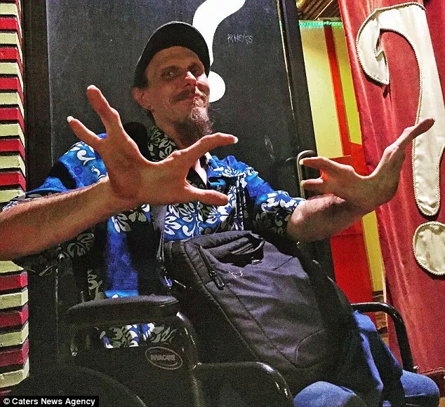 他用罪恶对抗悲惨命运，生理缺陷活被当成杀人利器