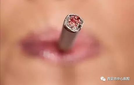 母亲节宫颈癌免费筛查,68岁有没有必要做宫颈癌筛查啊