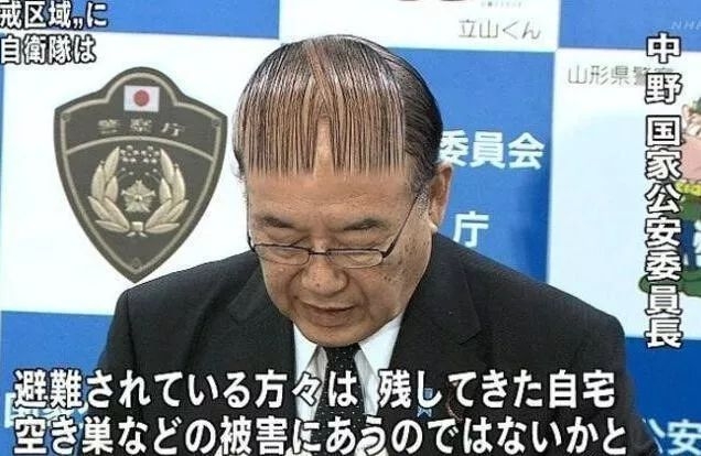 90后没有发际线,90后00后如何不脱发