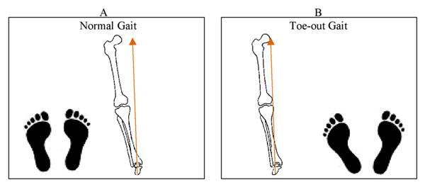 幼猫走路外八字怎么纠正,纠正内八字的训练方法