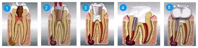 看牙又贵又遭罪,看牙那么贵没人管吗