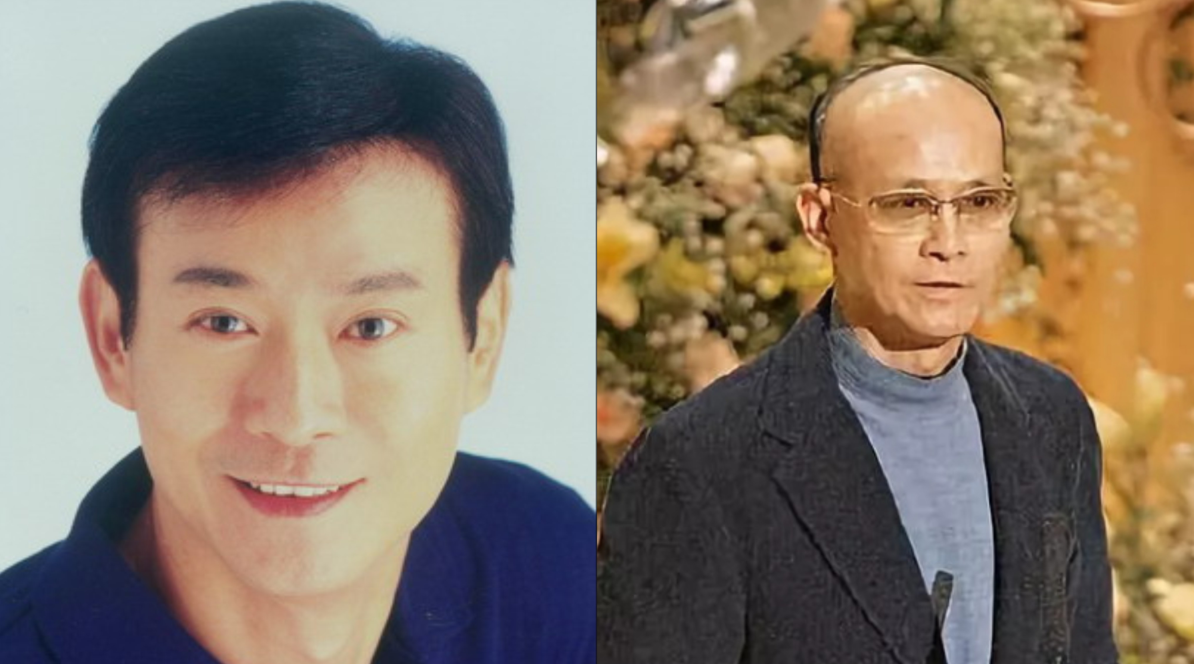 m型脱发也帅的男明星,帅气也挡不住脱发的10位男明星