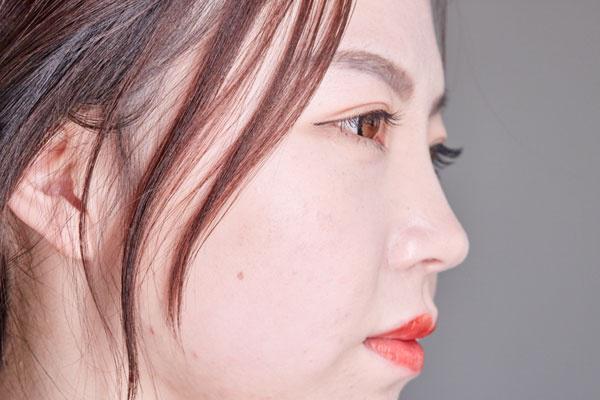 腋毛能真真正正的去掉吗,腋毛能根除吗