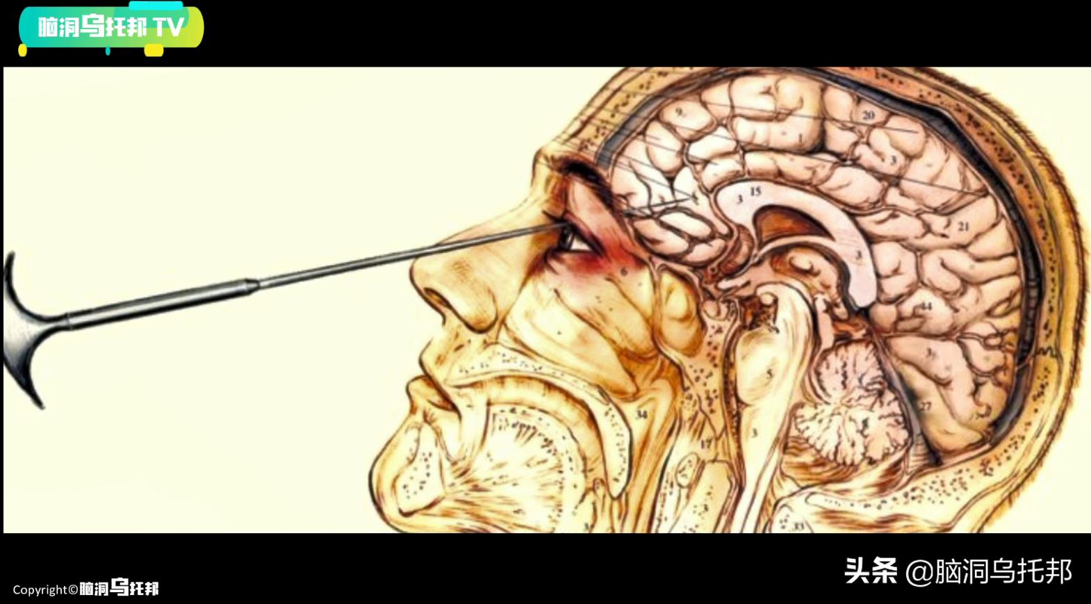 史上最具争议的心理学实验，8个正常人参与，7个变成了精神分裂者