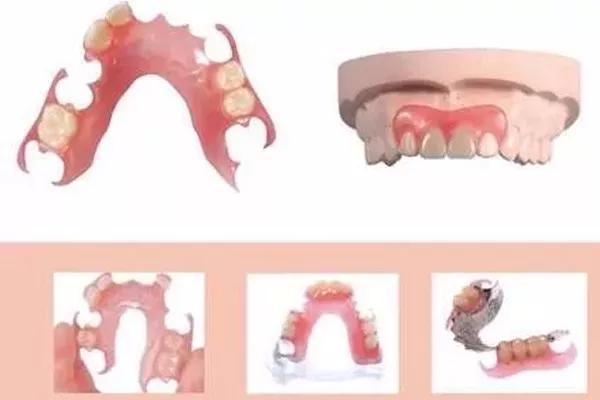 缺了一颗牙不影响吃饭,缺了一颗牙不补
