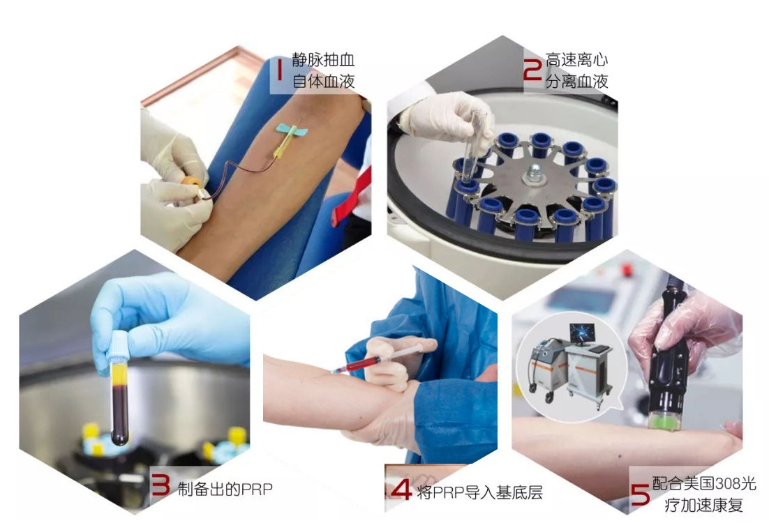 到底哪个国家治疗白癜风最好,中医治疗对称型白癜风