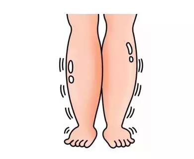 一针治下肢水肿,糖尿病下肢水肿