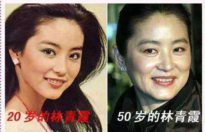 经常打玻尿酸10年后会有什么变化,连打几次玻尿酸就会持久呢