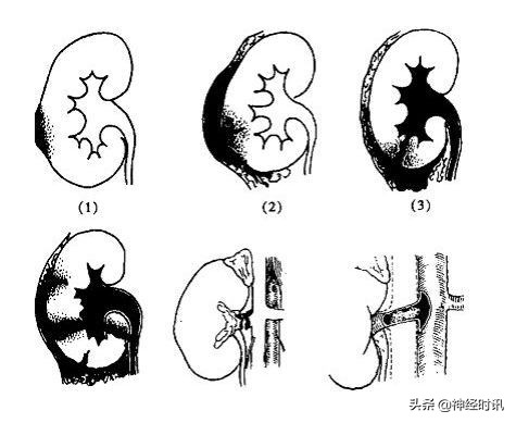 肾脏输尿管膀胱前列腺结构,肾输尿管膀胱解剖示意图