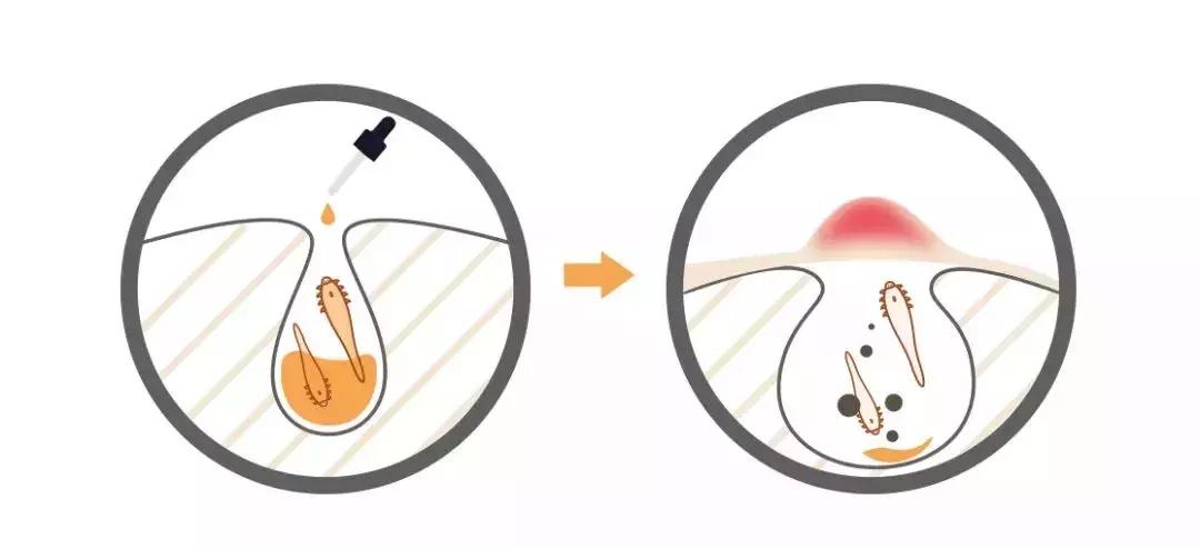 夏天就要心机露肤才更显瘦,又到了夏天露腿露肩的季节