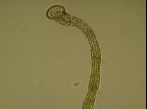 污泥镜检操作方法,污泥检测项目及标准有哪些呢