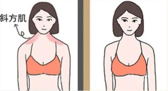 千万不要打瘦肩针你绝对想象不到,注射瘦肩针的正确方法