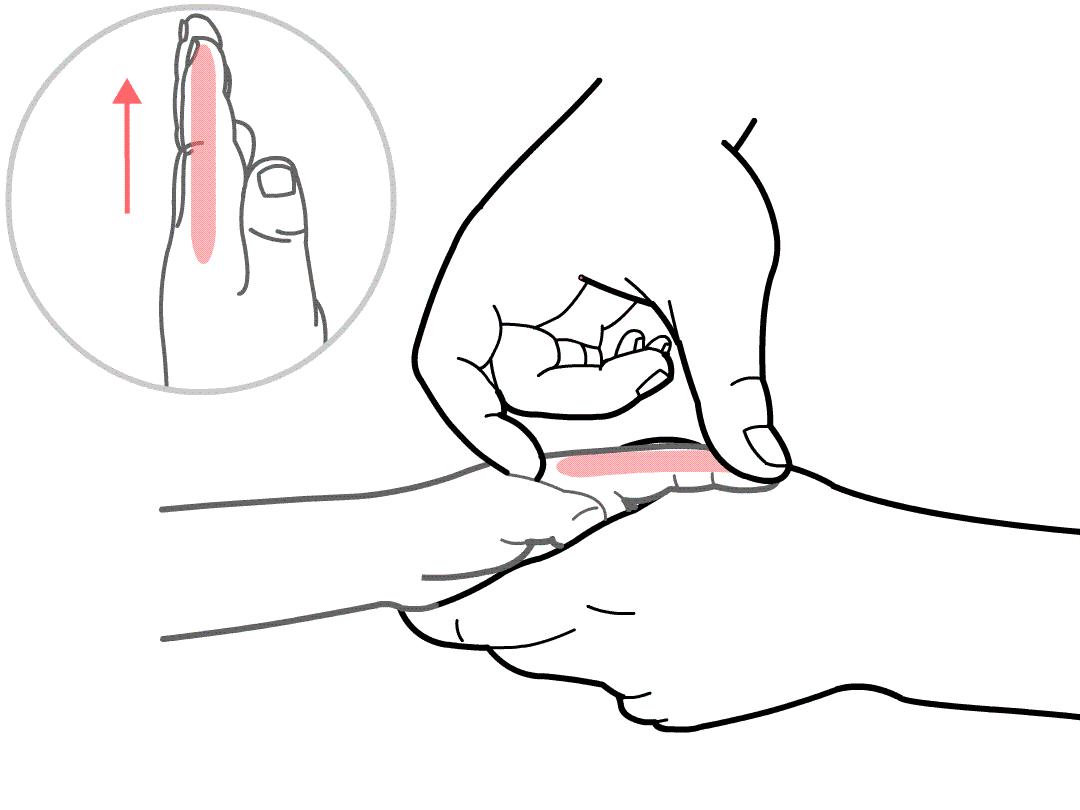 宝宝湿疹反复，中医小儿推拿有什么好方法？