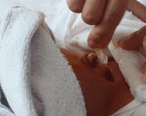 新生儿护理养育指南电子版,新生儿护理指南