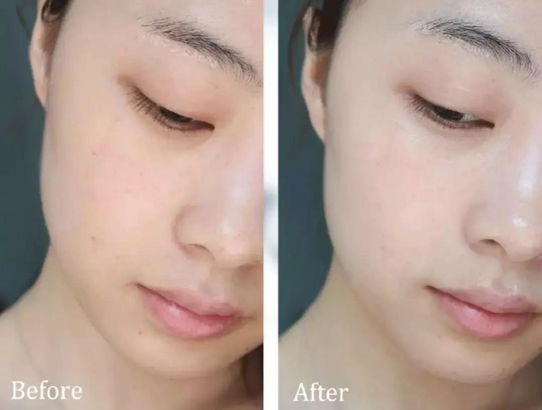 美妆知识小棕瓶,小棕瓶红腰子