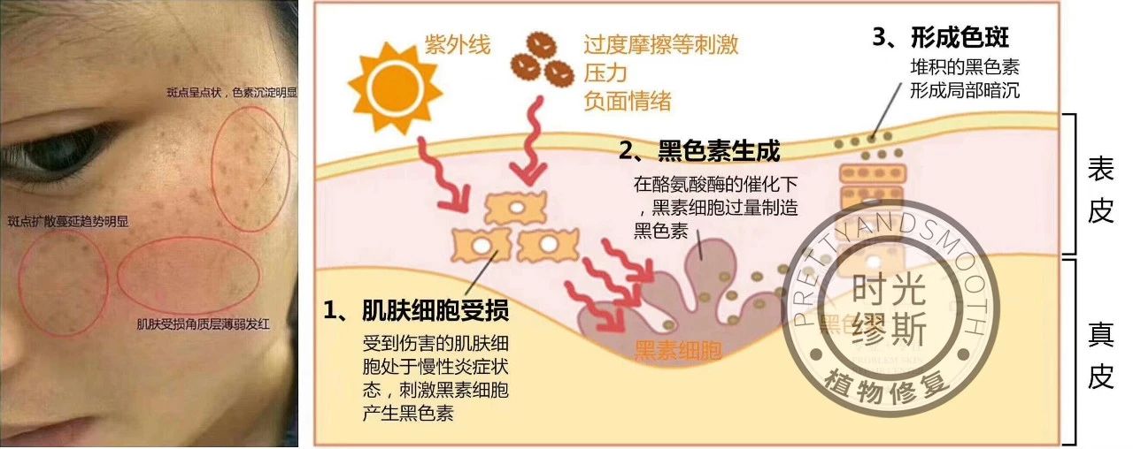 去晒斑护肤推荐,日晒斑用什么护肤品最好