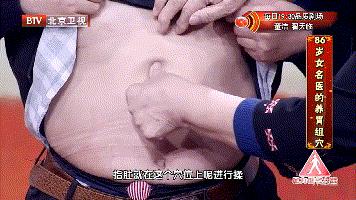 行医59年81岁老中医,一女子胃癌喝中药治好了