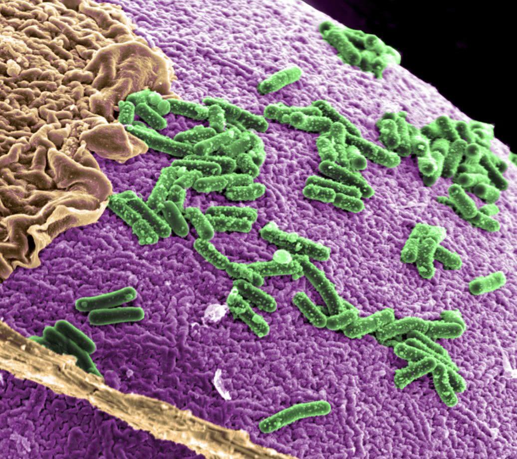 牛的胃竟然能分解塑料？世界难题就这样迎刃而解了吗？