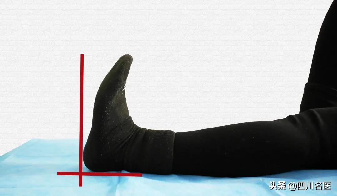 扁平足是不是走路容易脚疼,脚一走路就疼是扁平足吗