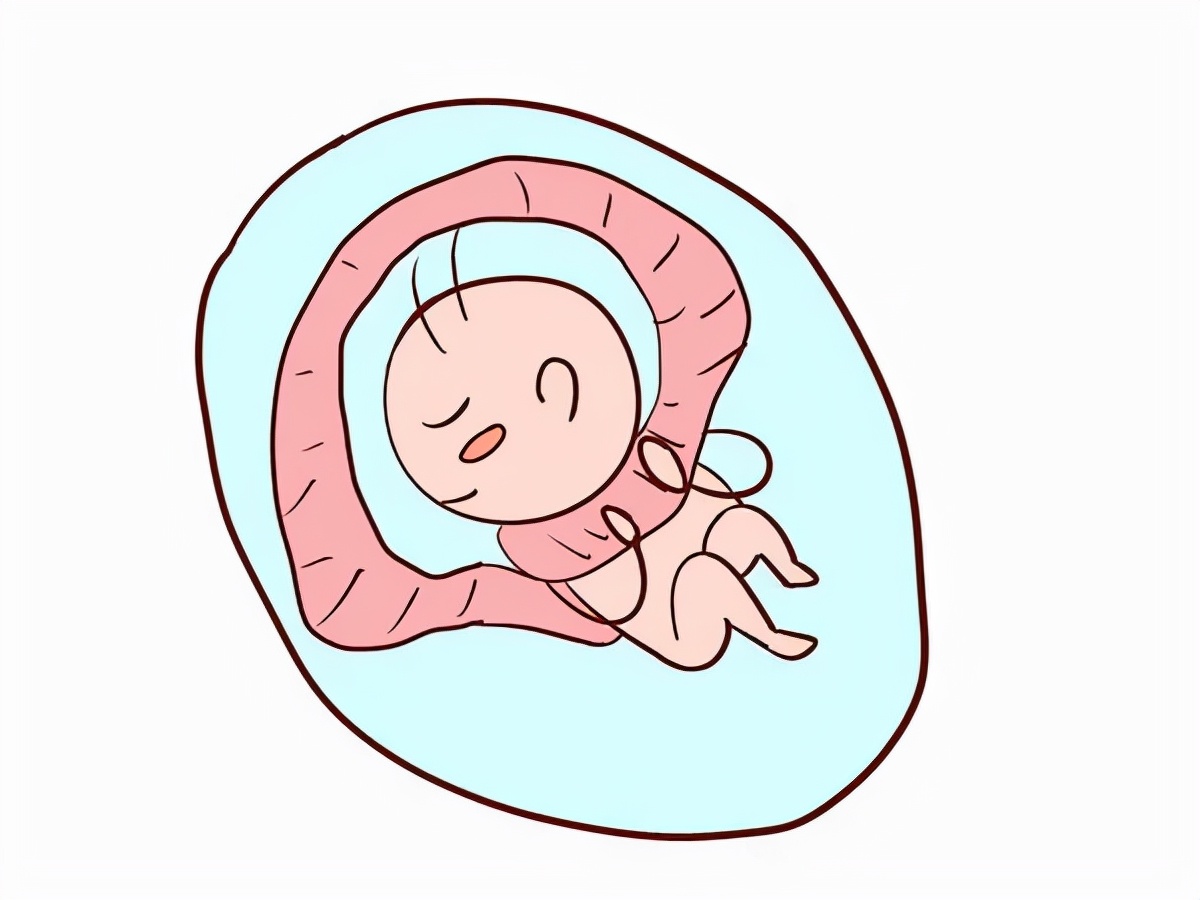 孕妈们胎儿脐带绕颈不要慌,脐带绕颈一般发生在多少周