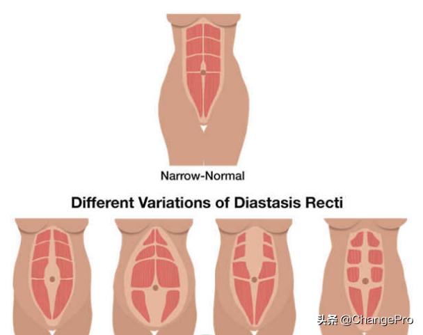 产后核心肌群训练10个经典动作,产后核心肌群恢复