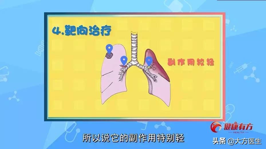 肺癌脑转移有没有治疗手段,中央型肺癌的治疗手段