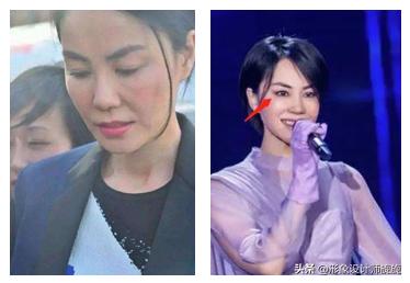 学生怎么让方脸变小v脸,脸大脸宽怎么科学变小