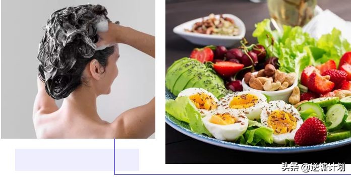 头皮发痒头皮屑多有小疙瘩怎么办,头皮严重发痒头皮屑多小妙招