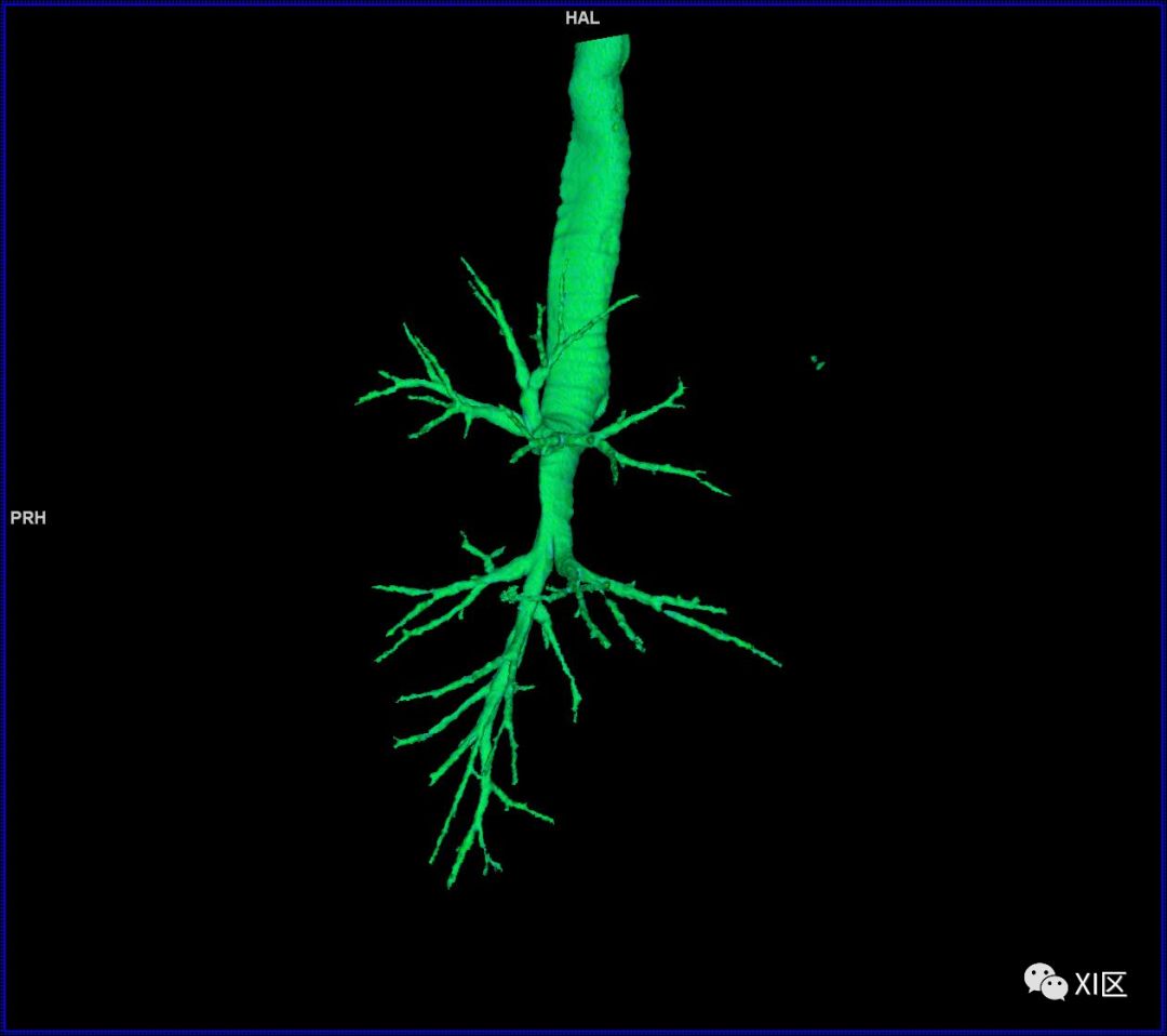如此详细的肺部影像解剖，有点儿酷！
