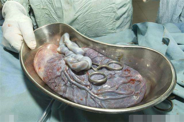 生完宝宝胎盘怎么处置,生完宝宝胎盘怎么处理合适