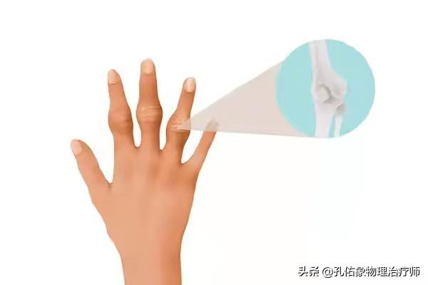 手指肿胀有硬硬的感觉,手指有结节有僵硬疼痛是什么病