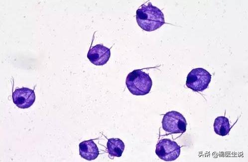 小便刺痛是不是尿道炎,小便刺痛尿道炎怎样治疗