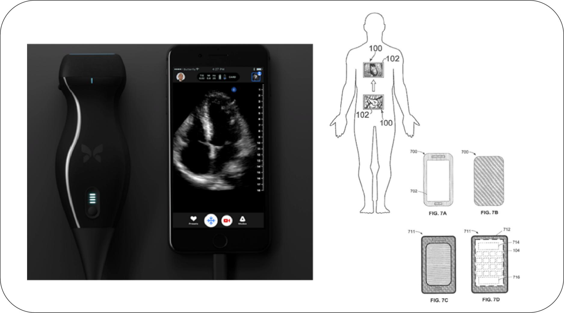 ai取代影像医生要多久,医学影像会被ai取代吗