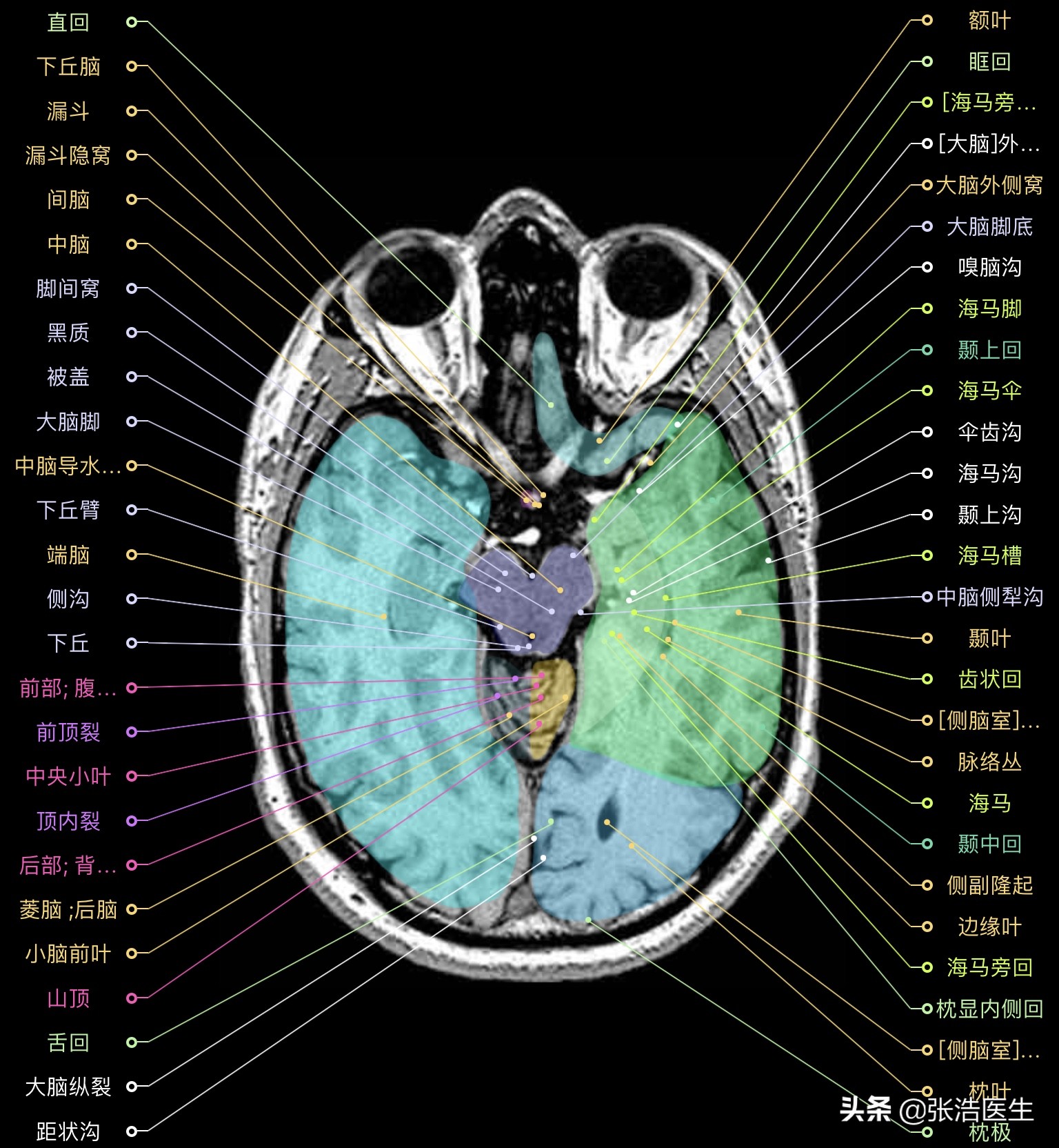 颅脑mri解剖影像检查是什么意思,颅脑mri断层解剖视频课件