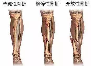 爱运动更好学习,爱运动保护好自己