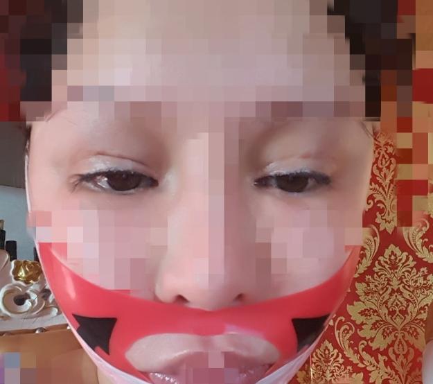 红粉宝宝整容失败案例,粉红女郎整容200多次