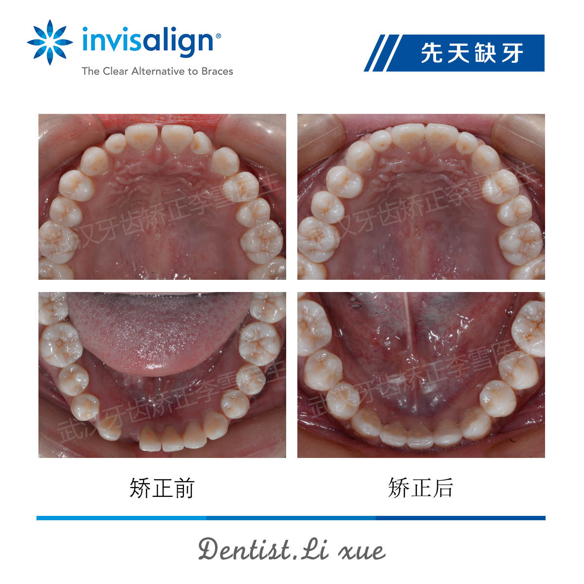 武汉牙齿矫正整形医生,武汉牙齿矫正医生推荐