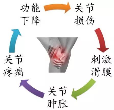 滑膜炎怎么贴黑膏药视频,滑膜炎通俗讲是什么