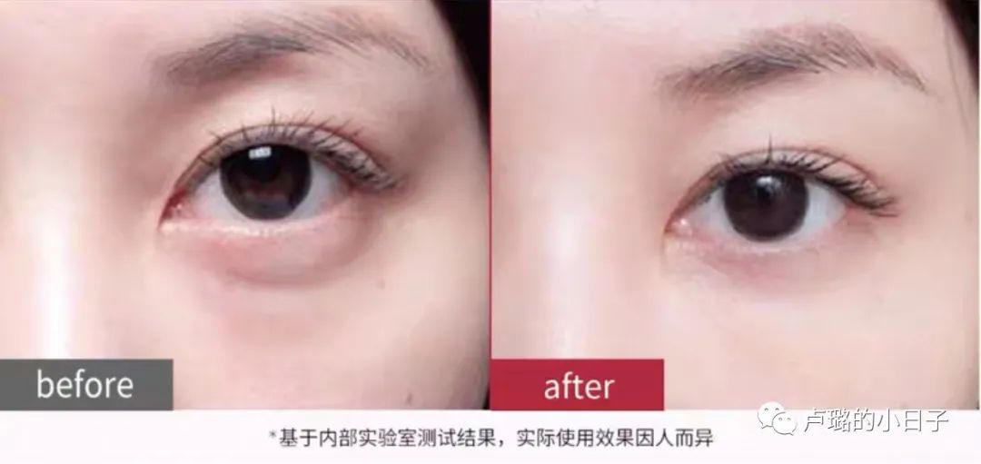 网红美容仪真实测评,深度分析六款当红美容仪