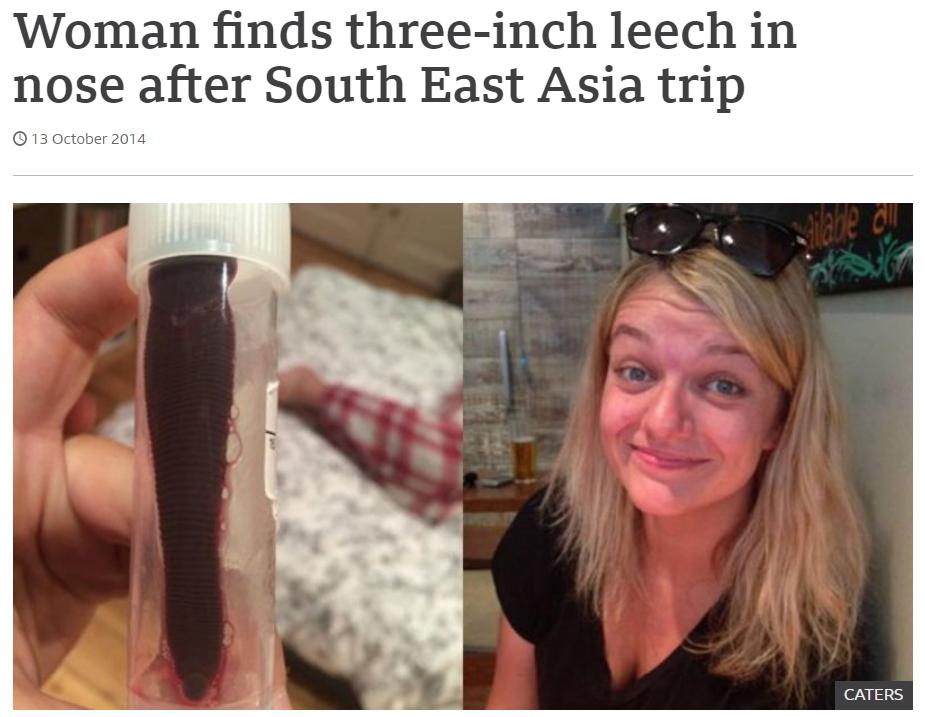 男孩被蚂蚁吓死,蚂蝗寄生在五岁男孩身体里一年