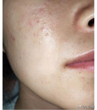 睡眠面膜适合油性皮肤,什么睡眠面膜适合20岁左右