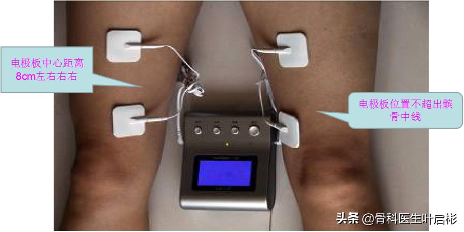 中老年男性常见的骨折,中老年人容易骨折怎么办