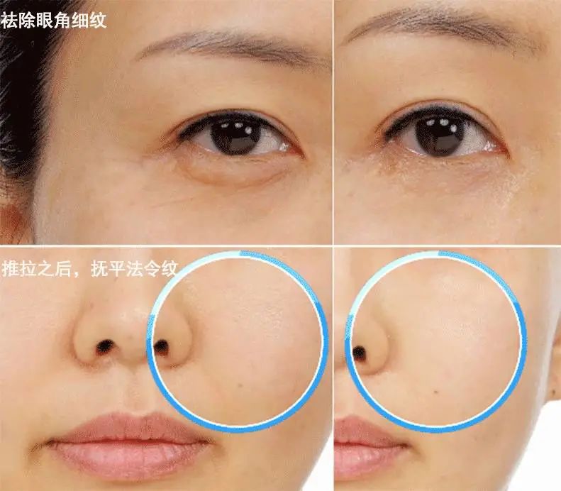 死海泥洗面膜怎么样,死海泥面膜的神奇功效是什么