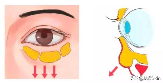 有什么沟必须火的,泪沟后面有一条很深的沟叫什么