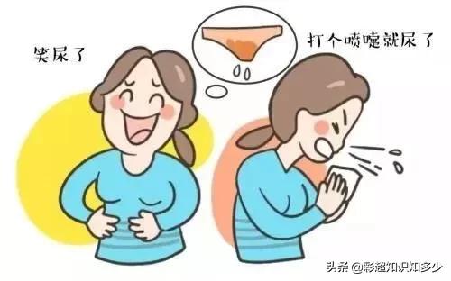 压力性尿失禁难道只有女生有吗,压力性尿湿症能自愈吗