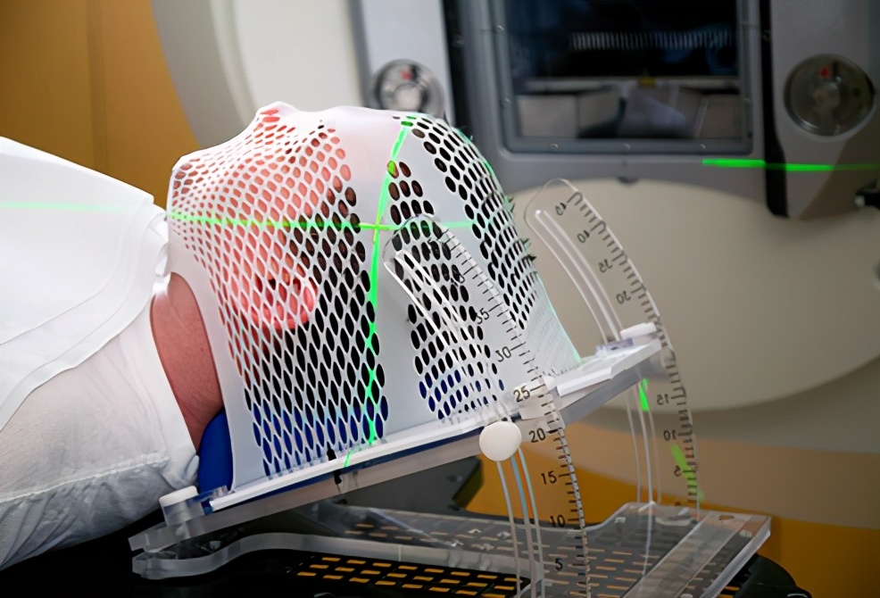 大脑是人体司令部，出现脑癌常会引起头痛等异常，该如何正确应对