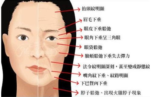 脸上有法令纹去除最好的方法,一般情况最早多大年龄出现法令纹