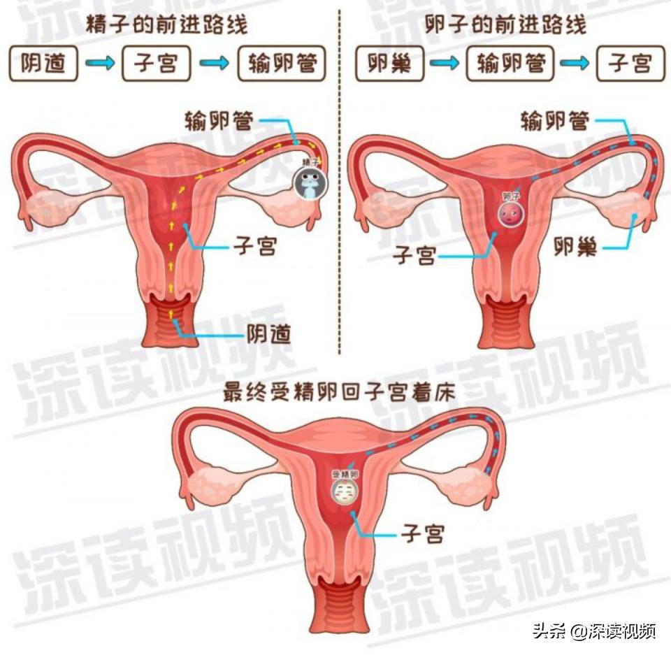 宫外孕一直流血怎么回事,宫外孕是怎么回事呢