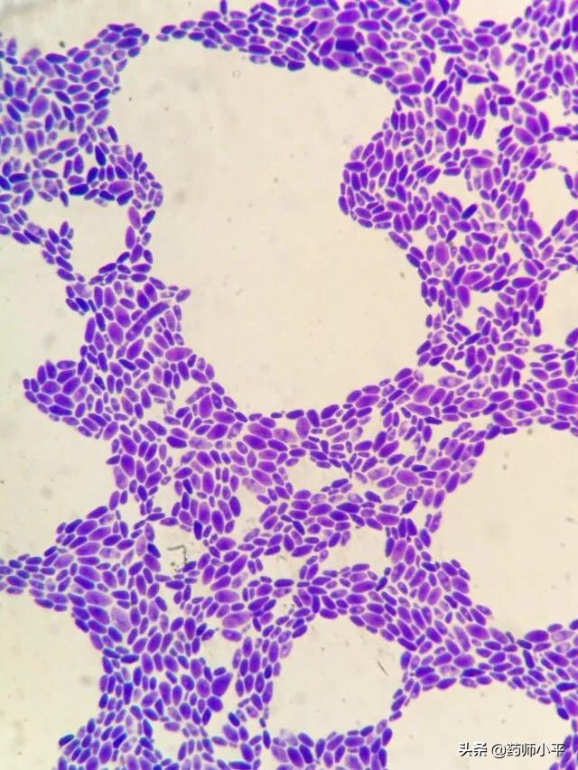 美国真菌感染死亡人数,美国超级真菌感染的症状