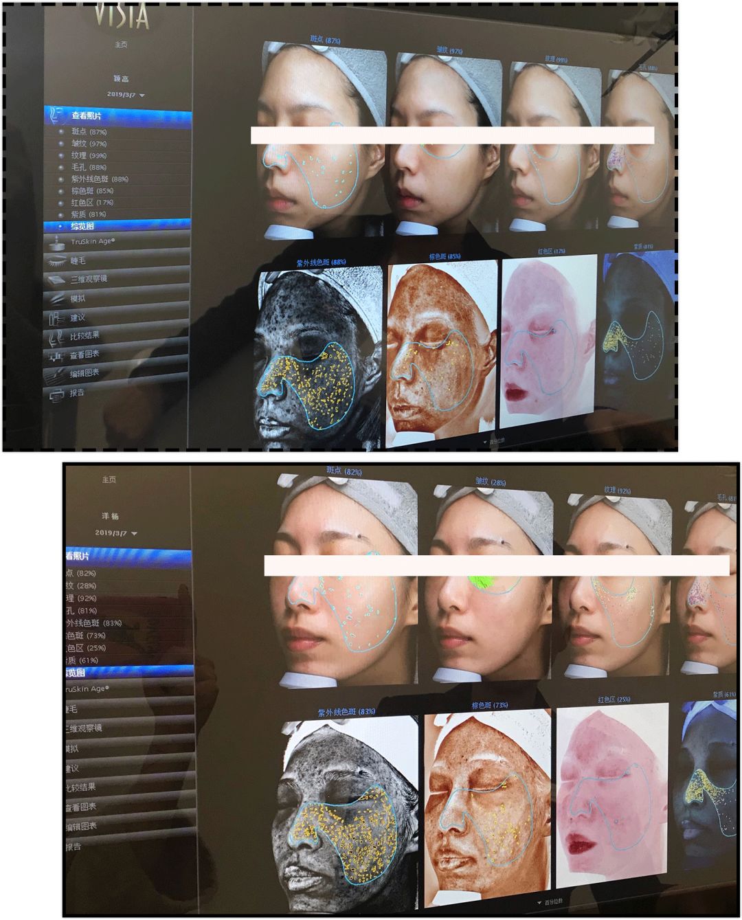 花3000块做一次皮肤护理，我后悔吗？